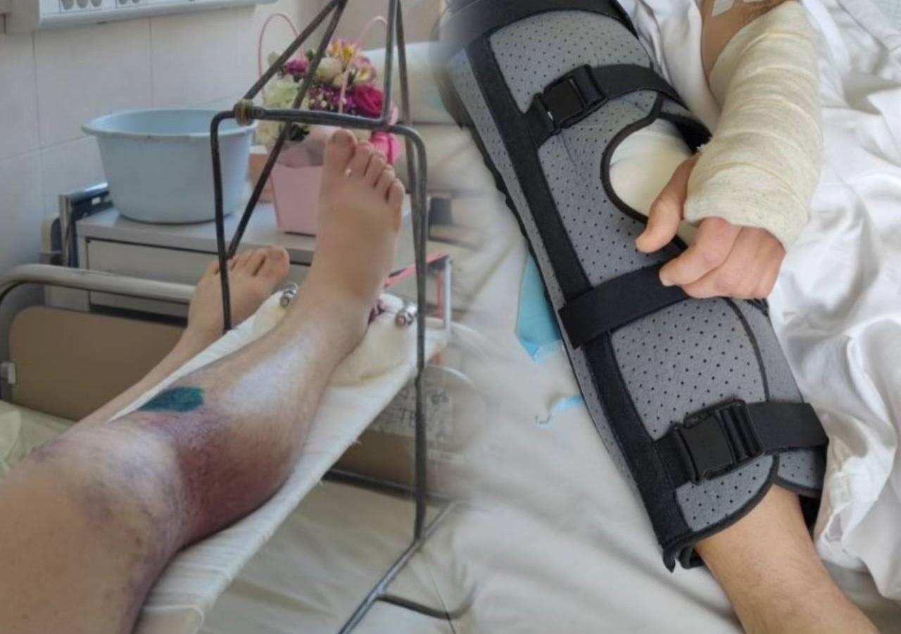 Замість швидкої — ТЦК: у Франківську розслідують інцидент із травмованим чоловіком під час оповіщення